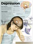 Understanding Depression Anatomical Chart